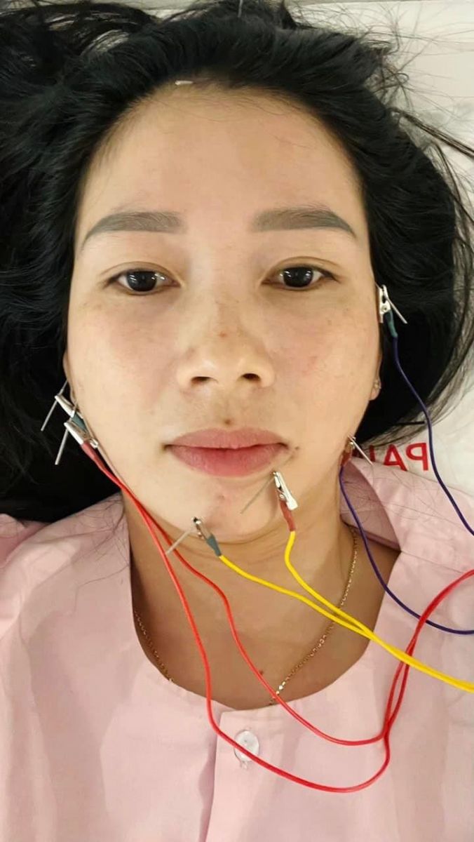 ĐIỀU TRỊ - VIÊM KHỚP THÁI DƯƠNG HÀM